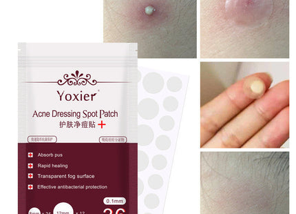 Skin Care Tools Acne Dressing Spot Patch Blemish Treatment Invisible Acne Stickers Pimple Remover Set Face Cream