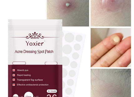 Skin Care Tools Acne Dressing Spot Patch Blemish Treatment Invisible Acne Stickers Pimple Remover Set Face Cream