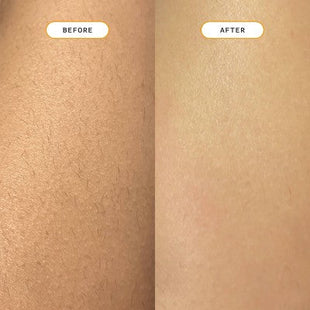Nood Ingrown Hair Treatment The Eraser - New