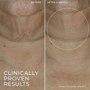 RoC Derm Correxion Retinol Face Stick - Imperfect Box