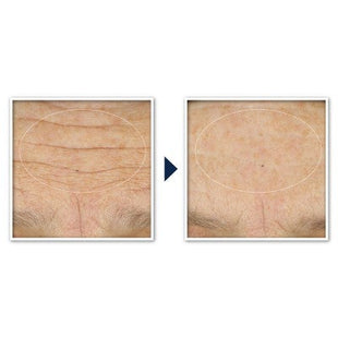 RoC Face & Neck Anti-Aging Moisturizer Firming Cream for Crepey Skin 1.7 fl oz - Imperfect Box