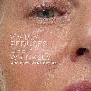 RoC Retinol Correxion Deep Wrinkle Rich Cream 1.7oz - Imperfect Box