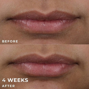 RoC Derm Correxion Lip Volumizer Treatment 0.34 fl oz - Imperfect Box