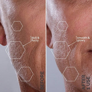 Spa Sciences SIMA Deluxe Sonic Dermaplaning Tool for Exfoliation & Peach Fuzz Removal - Imperfect Box