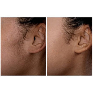Spa Sciences SIMA Deluxe Sonic Dermaplaning Tool for Exfoliation & Peach Fuzz Removal - Imperfect Box