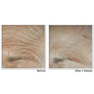 RoC Face & Neck Anti-Aging Moisturizer Firming Cream for Crepey Skin 1.7 fl oz - Imperfect Box