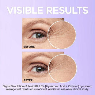 L'Oreal Paris Revitalift Derm Intensives Hyaluronic Acid+Caffeine 0.67 fl oz - Imperfect Box
