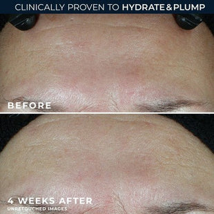 RoC Multi Correxion Hydrate + Plump Daily Moisturizer with Hyaluronic Acid SPF 30 1.7oz - Imperfect Box