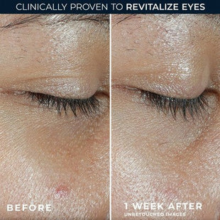 RoC Multi Correxion Revive and Glow Vitamin C Under Eye Balm 0.14oz - Imperfect Box
