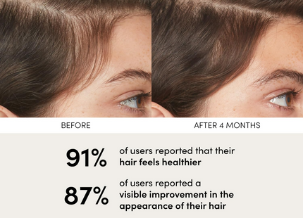 Ouai Scalp Serum