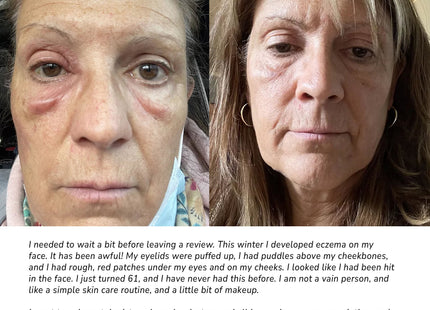 Pure + Simple Skin Kit for Sensitive Skin