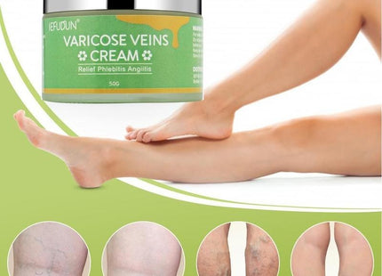 Vein Cream Red Blood Streaks Repair Earthworm Leg Bruises Bulge Relief Pain Safflower Skin care lotion Varicose Cream